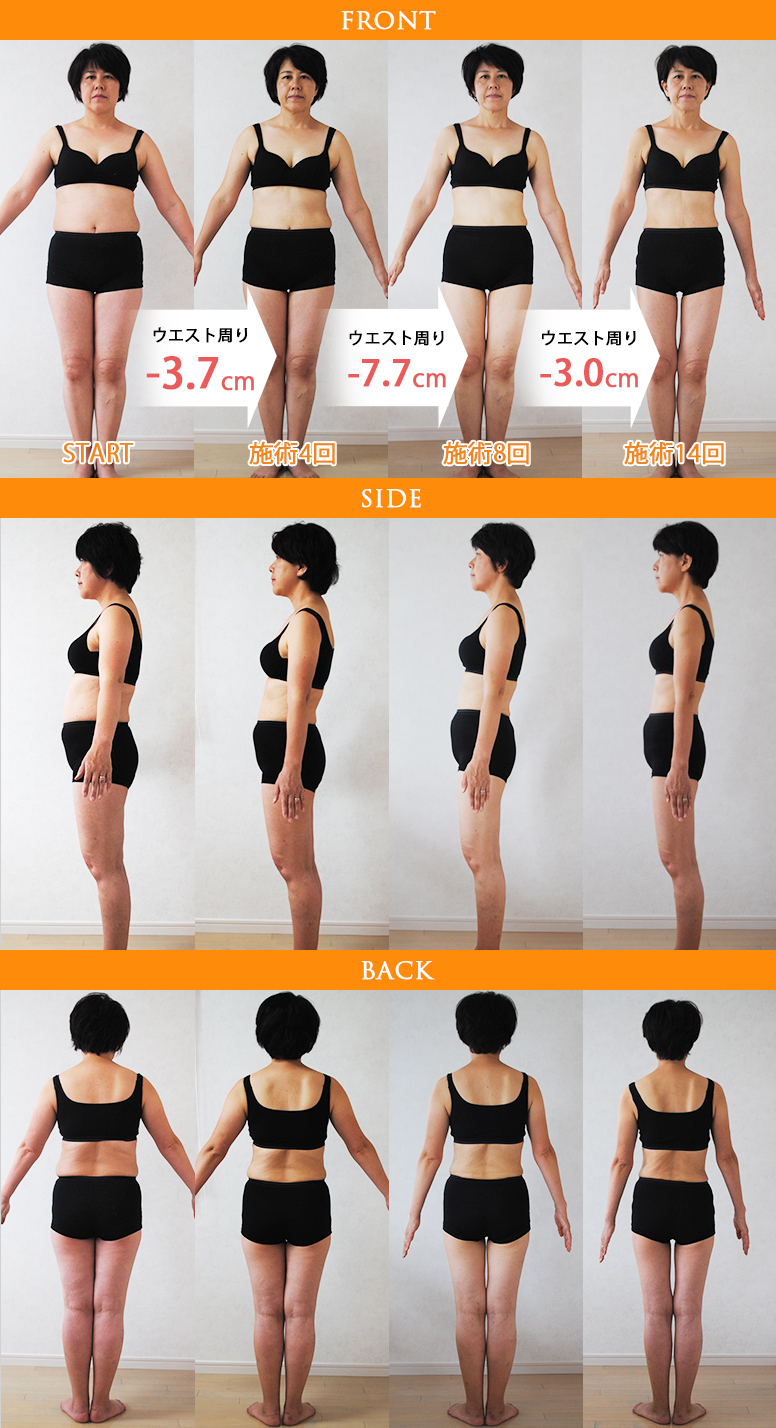 ダイエット ビフォーアフター
